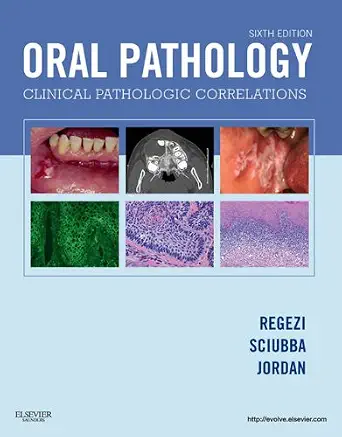 خرید و دانلود نسخه کامل کتاب Oral Pathology – E-Book_6a6669896b3c3.webp خرید و دانلود نسخه کامل کتاب Oral Pathology – E-Book