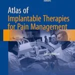 خرید و دانلود نسخه کامل کتاب Atlas of Implantable Therapies for Pain Management