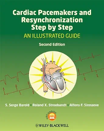 خرید و دانلود نسخه کامل کتاب Cardiac Pacemakers and Resynchronization Step by Step: An Illustrated Guide_6a6cfd4526b5a.webp خرید و دانلود نسخه کامل کتاب Cardiac Pacemakers and Resynchronization Step by Step: An Illustrated Guide