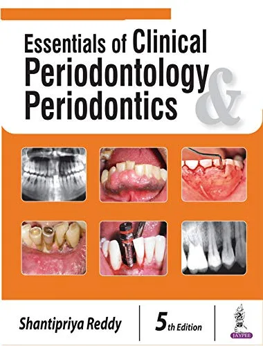خرید و دانلود نسخه کامل کتاب Essentials of Clinical Periodontology and Periodontics 5th Edition_6a67b3902427e.jpeg خرید و دانلود نسخه کامل کتاب Essentials of Clinical Periodontology and Periodontics 5th Edition