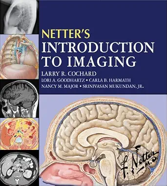 خرید و دانلود نسخه کامل کتاب Netter’s Introduction to Imaging E-Book (Netter Basic Science)_6a783e29568af.webp خرید و دانلود نسخه کامل کتاب Netter’s Introduction to Imaging E-Book (Netter Basic Science)