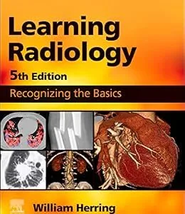 خرید و دانلود نسخه کامل کتاب Learning Radiology E-Book: Recognizing the Basics