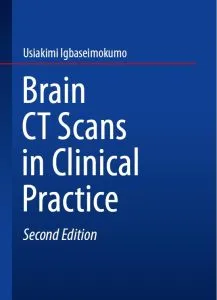 خرید و دانلود نسخه کامل کتاب Brain CT Scans_6a92a856de56f.webp خرید و دانلود نسخه کامل کتاب Brain CT Scans