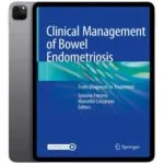 خرید و دانلود نسخه کامل کتاب انگلیسی Clinical Management of Bowel Endometriosis 2020