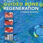 خرید و دانلود نسخه کامل کتاب 20 Years of Guided Bone Regeneration in Implant Dentistry: Second Edition