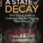 خرید و دانلود نسخه کامل کتاب A State of Decay: Your Dental Guide to Understanding and Treating "Meth Mouth"