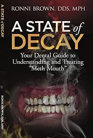 خرید و دانلود نسخه کامل کتاب A State of Decay: Your Dental Guide to Understanding and Treating “Meth Mouth”_6a660df8b0778.jpeg خرید و دانلود نسخه کامل کتاب A State of Decay: Your Dental Guide to Understanding and Treating "Meth Mouth" - تصویر 1