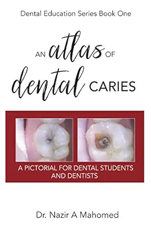 خرید و دانلود نسخه کامل کتاب An Atlas of Dental Caries: A Pictorial For Dental Students and Dentists_6a6513738d5c6.webp خرید و دانلود نسخه کامل کتاب An Atlas of Dental Caries: A Pictorial For Dental Students and Dentists - تصویر 1