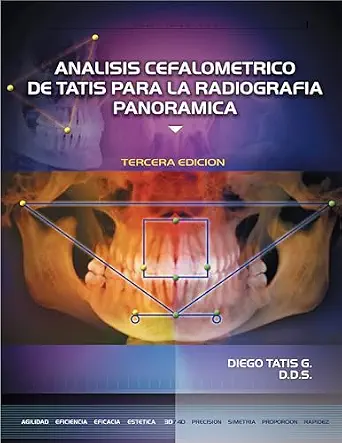 خرید و دانلود نسخه کامل کتاب Análisis Cefalometrico Para La Radiografía Panorámica (Spanish Edition)_6a65d234e08df.webp خرید و دانلود نسخه کامل کتاب Análisis Cefalometrico Para La Radiografía Panorámica (Spanish Edition) - تصویر 1