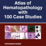 خرید و دانلود نسخه کامل کتاب 
Atlas of Hematopathology with 100 Case Studies سورنا بوک