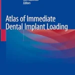 خرید و دانلود نسخه کامل کتاب Atlas of Immediate Dental Implant Loading