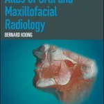 خرید و دانلود نسخه کامل کتاب Atlas of Oral and Maxillofacial Radiology