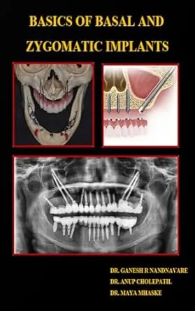 خرید و دانلود نسخه کامل کتاب BASICS OF BASAL AND ZYGOMATIC IMPLANTS_6a62f3cc03a28.jpeg خرید و دانلود نسخه کامل کتاب BASICS OF BASAL AND ZYGOMATIC IMPLANTS - تصویر 1