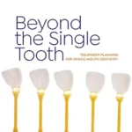خرید و دانلود نسخه کامل کتاب Beyond the single tooth: Treatment planning for whole mouth dentistry