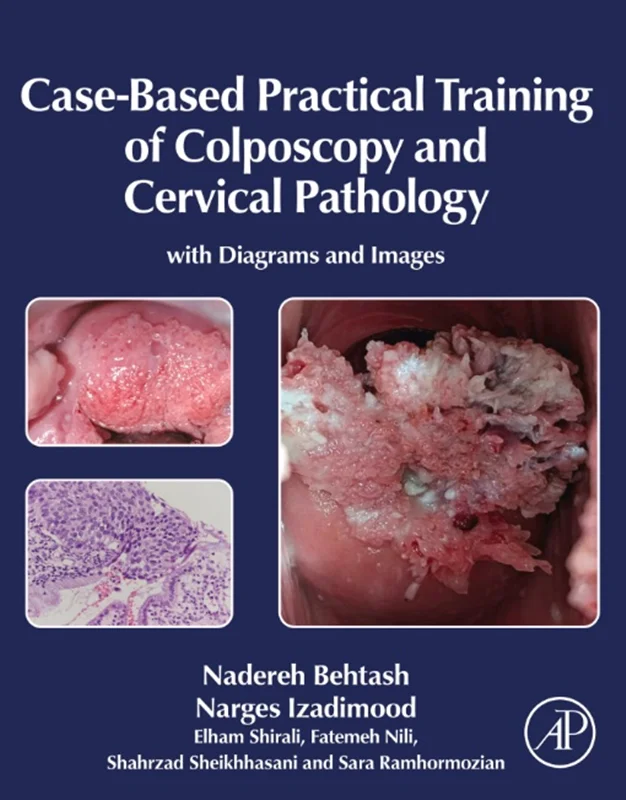 خرید و دانلود نسخه کامل کتاب
Case-Based Practical Training of Colposcopy and Cervical Pathology: With Diagrams and Images_6a5dced93386f.webp خرید و دانلود نسخه کامل کتاب
Case-Based Practical Training of Colposcopy and Cervical Pathology: With Diagrams and Images سورنا بوک - تصویر 1