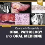 خرید و دانلود نسخه کامل کتاب Cawson's Essentials of Oral Pathology and Oral Medicine: Cawson's Essentials of Oral Pathology and Oral Medicine - E-Book