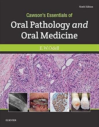خرید و دانلود نسخه کامل کتاب Cawson’s Essentials of Oral Pathology and Oral Medicine E-Book_6a63004e39d7d.jpeg خرید و دانلود نسخه کامل کتاب Cawson's Essentials of Oral Pathology and Oral Medicine E-Book - تصویر 1