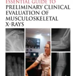 خرید و دانلود نسخه کامل کتاب 
Clark’s Essential Guide to Preliminary Clinical Evaluation of Musculoskeletal X-rays: Evaluating and Commenting on Images