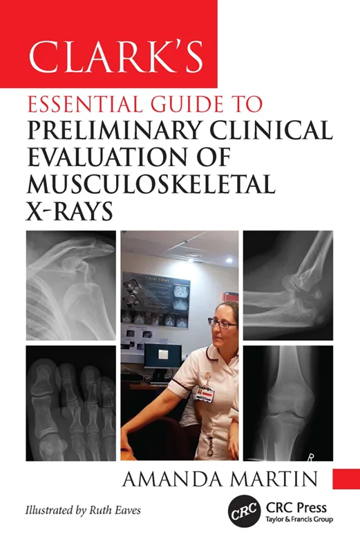 خرید و دانلود نسخه کامل کتاب
Clark’s Essential Guide to Preliminary Clinical Evaluation of Musculoskeletal X-rays: Evaluating and Commenting on Images_6a5e5f1355056.webp خرید و دانلود نسخه کامل کتاب
Clark’s Essential Guide to Preliminary Clinical Evaluation of Musculoskeletal X-rays: Evaluating and Commenting on Images - تصویر 1