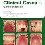خرید و دانلود نسخه کامل کتاب Clinical Cases in Gerodontology (Clinical Cases (Dentistry))