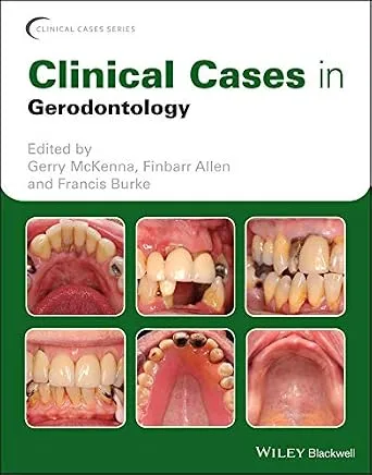 خرید و دانلود نسخه کامل کتاب Clinical Cases in Gerodontology (Clinical Cases (Dentistry))_6a6606e31cb6c.jpeg خرید و دانلود نسخه کامل کتاب Clinical Cases in Gerodontology (Clinical Cases (Dentistry)) - تصویر 1