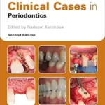 خرید و دانلود نسخه کامل کتاب Clinical Cases in Periodontics (Clinical Cases (Dentistry))