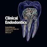 خرید و دانلود نسخه کامل کتاب Clinical Endodontics