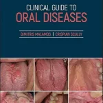خرید و دانلود نسخه کامل کتاب Clinical Guide to Oral Diseases