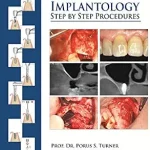 خرید و دانلود نسخه کامل کتاب Clinical Guide to Oral Implantology: Step by Step Procedures