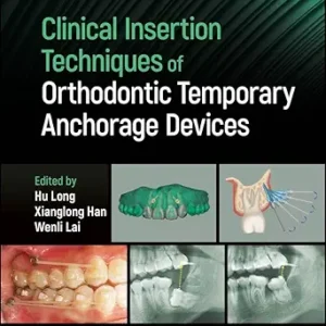 خرید و دانلود نسخه کامل کتاب Clinical Insertion Techniques of Orthodontic Temporary Anchorage Devices
