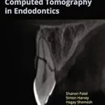 خرید و دانلود نسخه کامل کتاب Cone Beam Computed Tomography in Endodontics