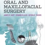 خرید و دانلود نسخه کامل کتاب Contemporary Oral and Maxillofacial Surgery - E-Book 6th Edition