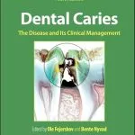 خرید و دانلود نسخه کامل کتاب Dental Caries: The Disease and its Clinical Management