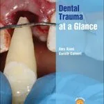 خرید و دانلود نسخه کامل کتاب Dental Trauma at a Glance (At a Glance (Dentistry)) 1st Edition