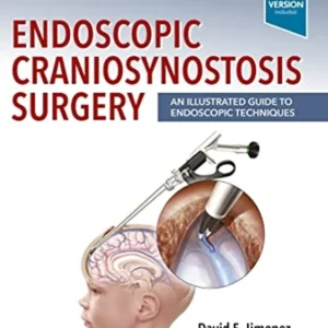 خرید و دانلود نسخه کامل کتاب 
Endoscopic Craniosynostosis Surgery: An Illustrated Guide to Endoscopic Techniques