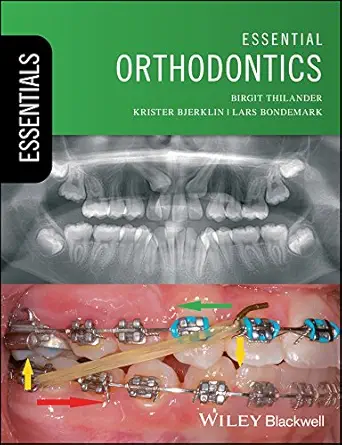 خرید و دانلود نسخه کامل کتاب Essential Orthodontics (Essentials (Dentistry))_6a65181075fb3.webp خرید و دانلود نسخه کامل کتاب Essential Orthodontics (Essentials (Dentistry)) - تصویر 1