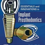 خرید و دانلود نسخه کامل کتاب Essentials and Innovations in Implant Prosthodontics - E-Book