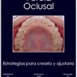 خرید و دانلود نسخه کامل کتاب FÉRULA OCLUSAL: ESTRATEGIAS PARA CREARLA Y AJUSTARLA (Spanish Edition)