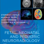 خرید و دانلود نسخه کامل کتاب 
Fetal, Neonatal and Pediatric Neuroradiology سورنا بوک
