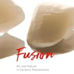 خرید و دانلود نسخه کامل کتاب Fusion: Art and Nature in Ceramic Restorations