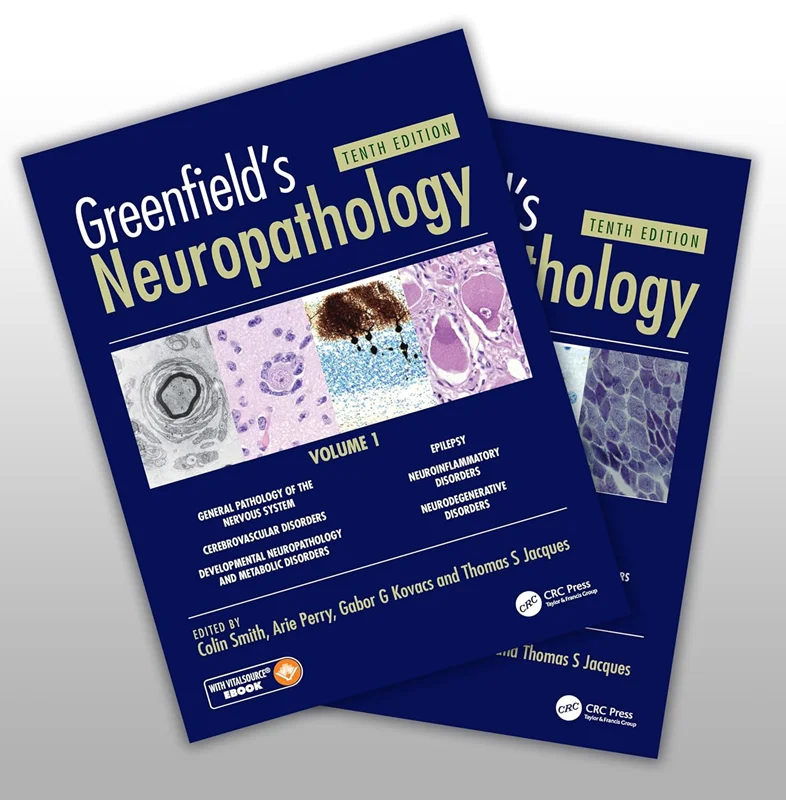 خرید و دانلود نسخه کامل کتاب
Greenfield’s Neuropathology 10e Set 10th Edition by Colin Smith, Arie Perry, Gabor Kovacs, Thomas Jacques_6a5e6212541ef.webp خرید و دانلود نسخه کامل کتاب
Greenfield's Neuropathology 10e Set 10th Edition by Colin Smith, Arie Perry, Gabor Kovacs, Thomas Jacques - تصویر 1