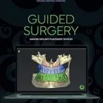 خرید و دانلود نسخه کامل کتاب GUIDED SURGERY: Making implant placement simpler