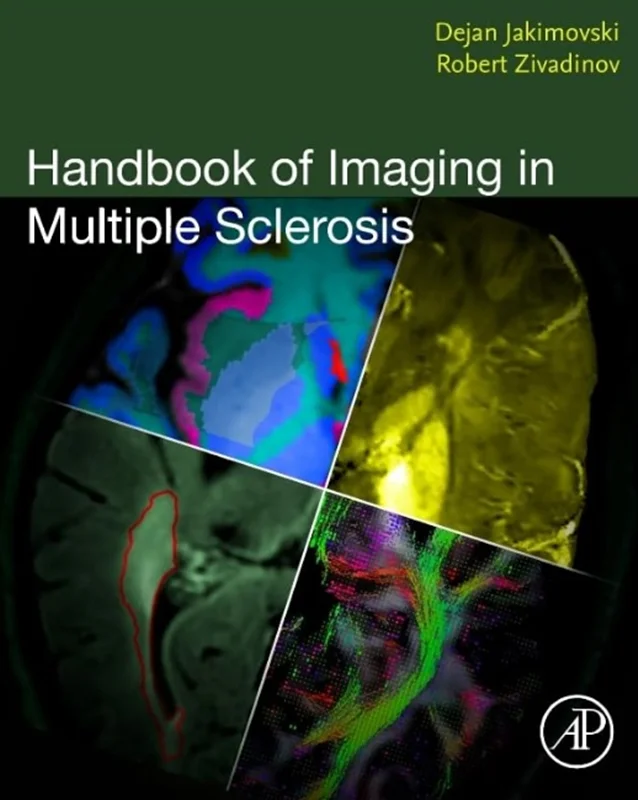 خرید و دانلود نسخه کامل کتاب
Handbook of Imaging in Multiple Sclerosis_6a5ea6c22c8ec.webp خرید و دانلود نسخه کامل کتاب
Handbook of Imaging in Multiple Sclerosis - تصویر 1