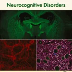 خرید و دانلود نسخه کامل کتاب 
HIV-Associated Neurocognitive Disorders سورنا بوک