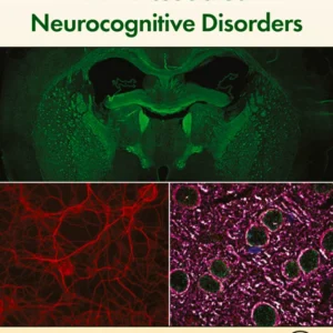 خرید و دانلود نسخه کامل کتاب 
HIV-Associated Neurocognitive Disorders سورنا بوک