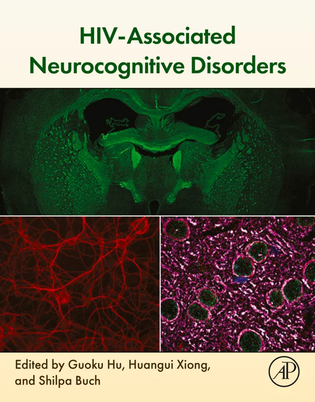 خرید و دانلود نسخه کامل کتاب
HIV-Associated Neurocognitive Disorders_6a5d55583761c.webp خرید و دانلود نسخه کامل کتاب
HIV-Associated Neurocognitive Disorders سورنا بوک - تصویر 1