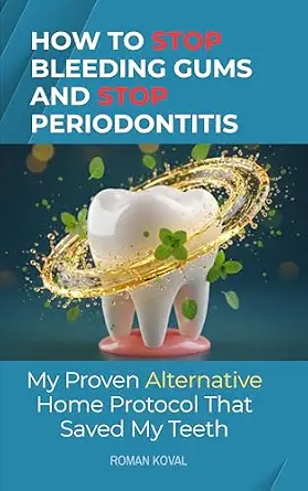 خرید و دانلود نسخه کامل کتاب How to Stop Bleeding Gums and Stop Periodontitis: My Proven Alternative Home Protocol That Saved My Teeth_6a650a3007b8a.webp خرید و دانلود نسخه کامل کتاب How to Stop Bleeding Gums and Stop Periodontitis: My Proven Alternative Home Protocol That Saved My Teeth - تصویر 1