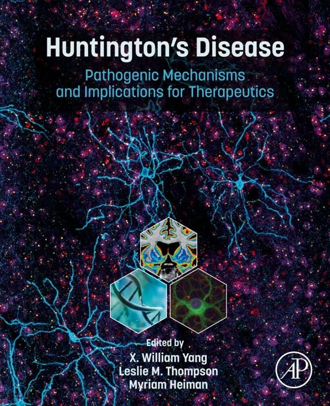 خرید و دانلود نسخه کامل کتاب
Huntington’s Disease: Pathogenic Mechanisms and Implications for Therapeutics_6a5d521dde810.webp خرید و دانلود نسخه کامل کتاب
Huntington's Disease: Pathogenic Mechanisms and Implications for Therapeutics سورنا بوک - تصویر 1