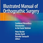 خرید و دانلود نسخه کامل کتاب Illustrated Manual of Orthognathic Surgery: Combined Bimaxillary Osteotomies in the Facial Skeleton