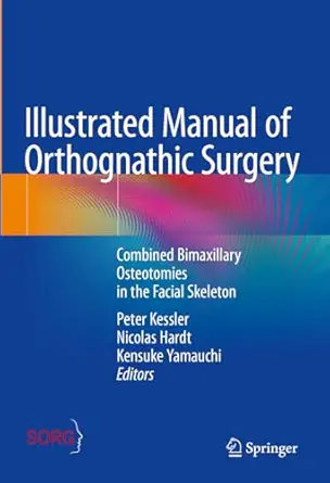 خرید و دانلود نسخه کامل کتاب Illustrated Manual of Orthognathic Surgery: Combined Bimaxillary Osteotomies in the Facial Skeleton_6a62b01789b9b.webp خرید و دانلود نسخه کامل کتاب Illustrated Manual of Orthognathic Surgery: Combined Bimaxillary Osteotomies in the Facial Skeleton - تصویر 1